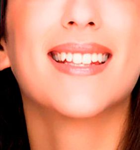 Ortodoncia Exclusiva Dra. María Jesús Díez García mujer sonriendo