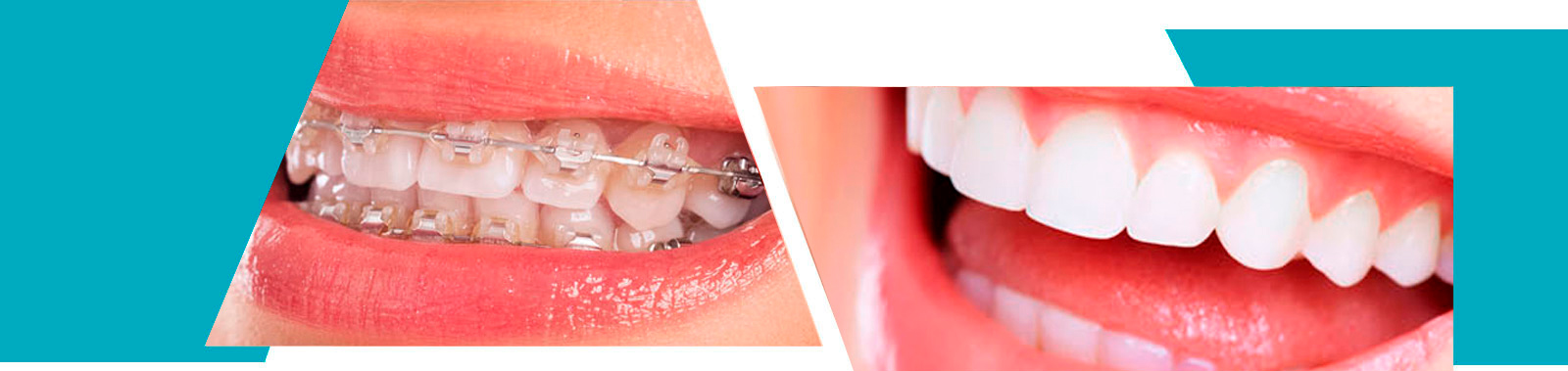 Ortodoncia Exclusiva Dra. María Jesús Díez García collage imagen 2