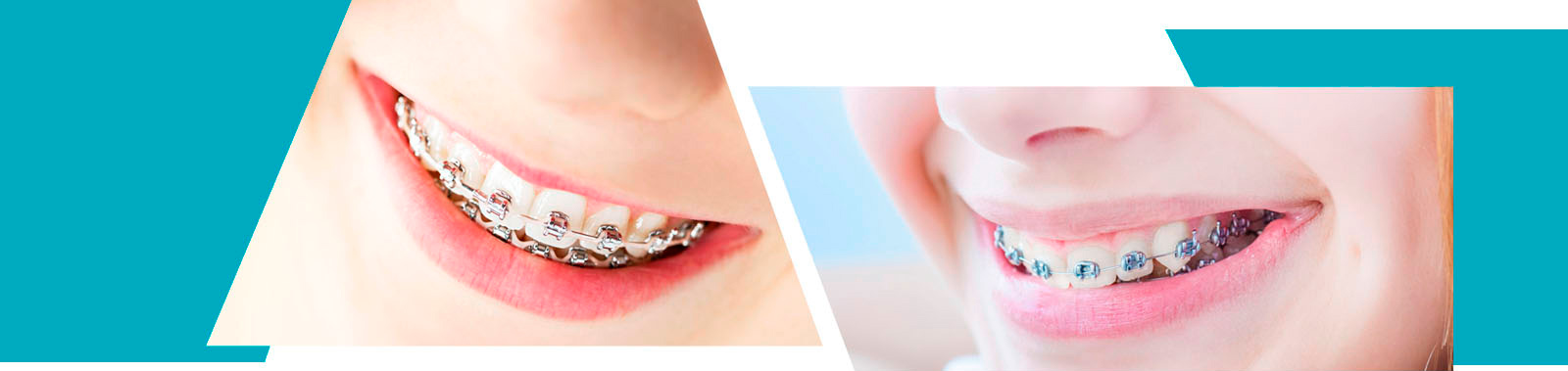 Ortodoncia Exclusiva Dra. María Jesús Díez García collage imagen 1